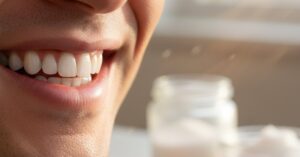 Naturalne metody wybielania zębów w domu: Bielszy uśmiech bez chemii